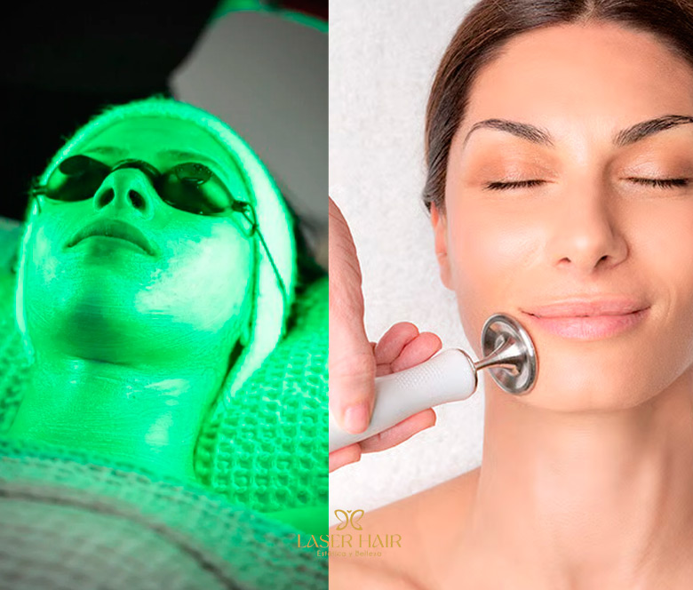 Radiofrecuencia + polinucleotidos + cromoterapia.