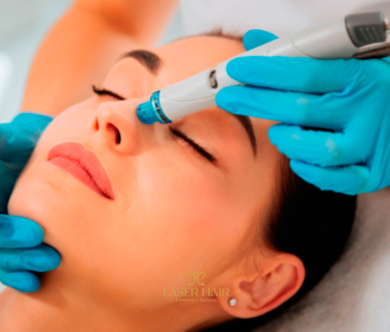 Tratamientos Faciales Belleza y Estética LASER HAIR