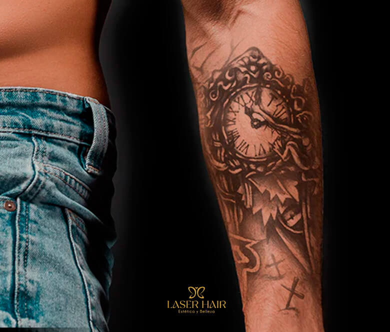 Eliminación tatuajes medianos Torrejón de Ardoz Madrid en Laser Hair