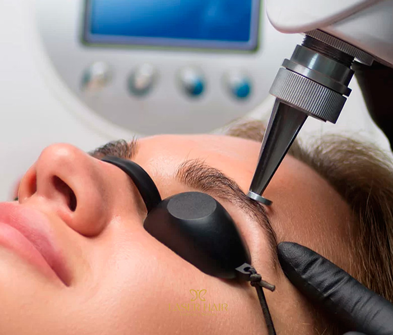 Eliminación de microblanding en cejas mal hechas. Madrid